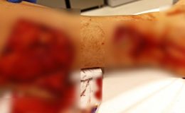 Adana’da sahibini kıskanan köpek saldırdı: Bacağını parçaladı